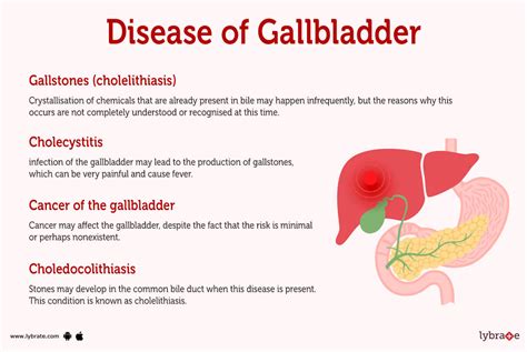 medical tests for gallbladder infection